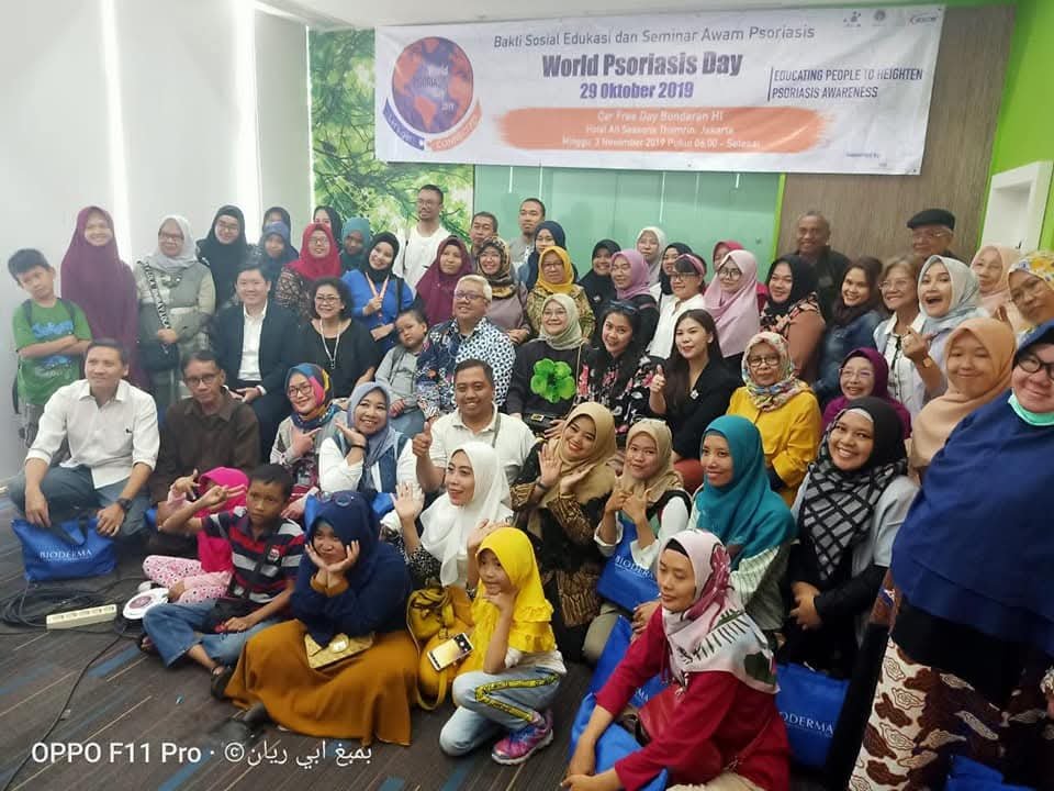 Psoriasis Nusantara indonesia, dermatologi ipsoriasis ndonesia