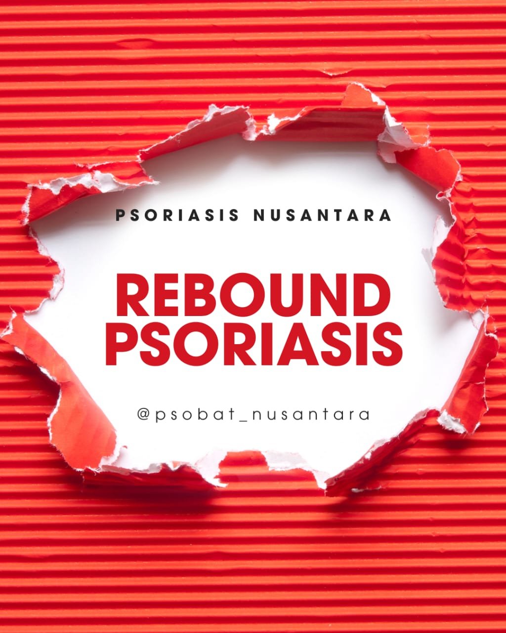 Rebound psoriasis