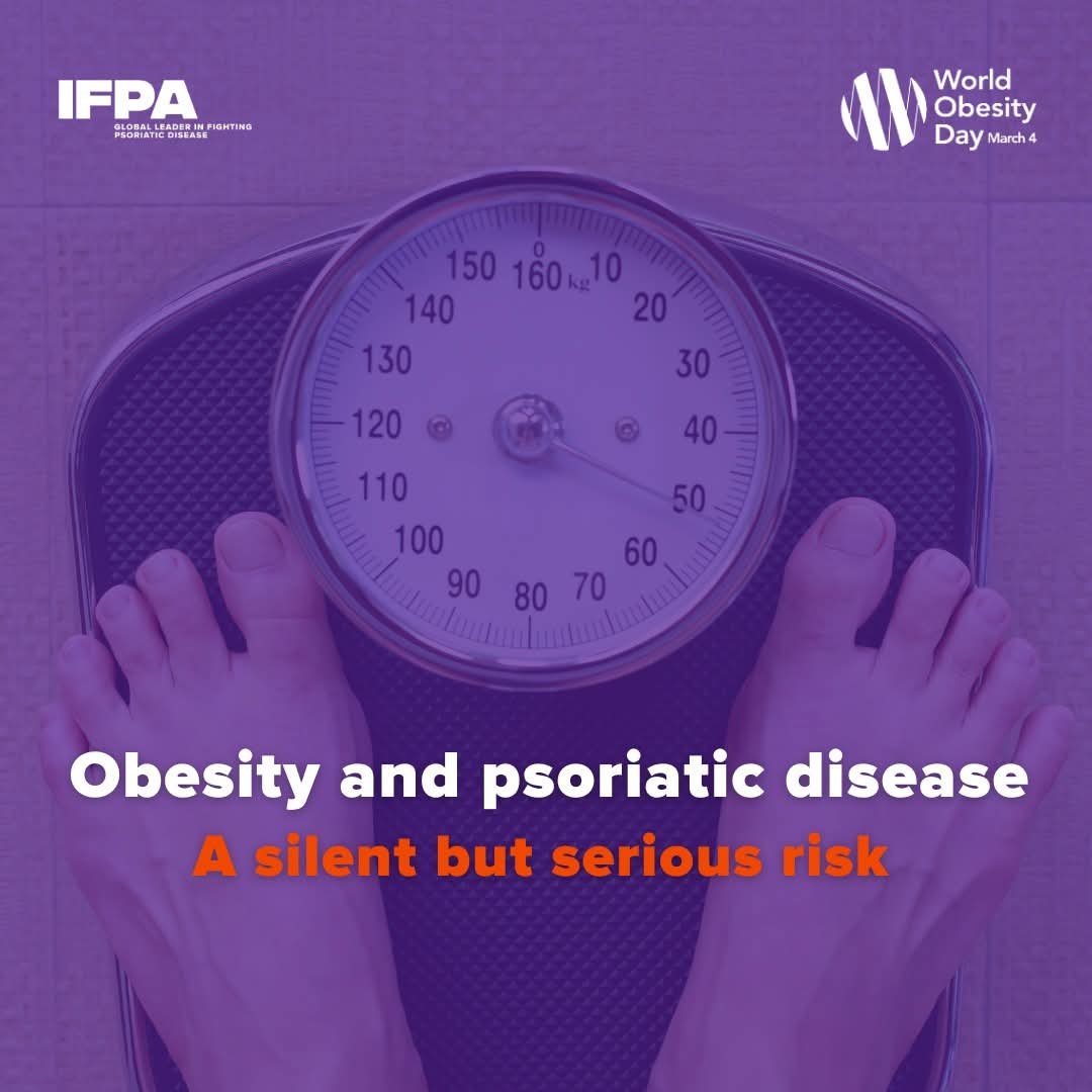 Psoriasis dan Obesitas